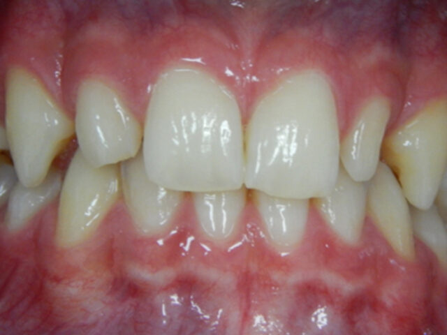 Before - puredental
