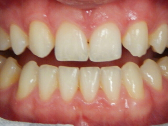 Before - puredental