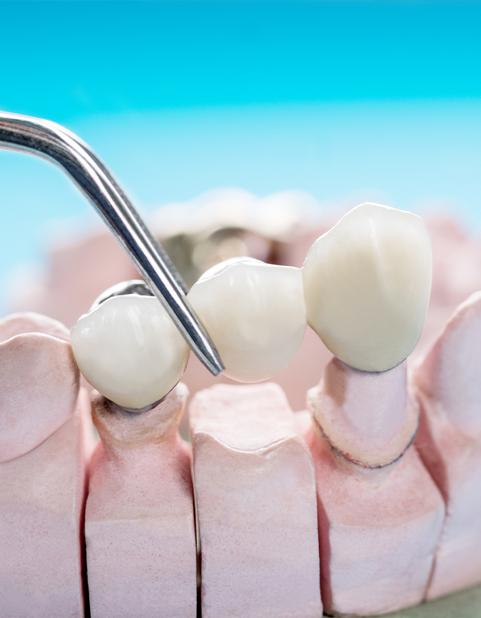 Treatment - Pure Dental