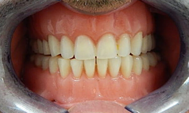 After - puredental