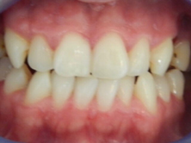 Before - puredental
