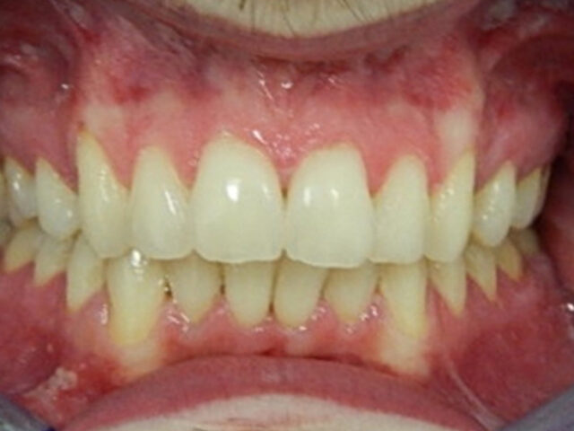 Before - puredental