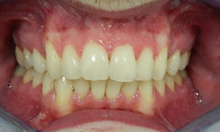 Before - puredental