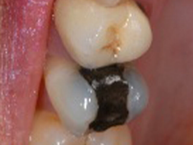 Before - puredental