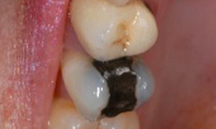 Before - puredental