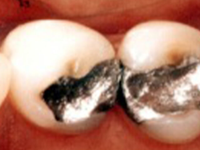 Before - puredental