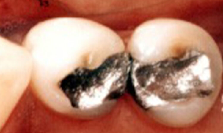 Before - puredental