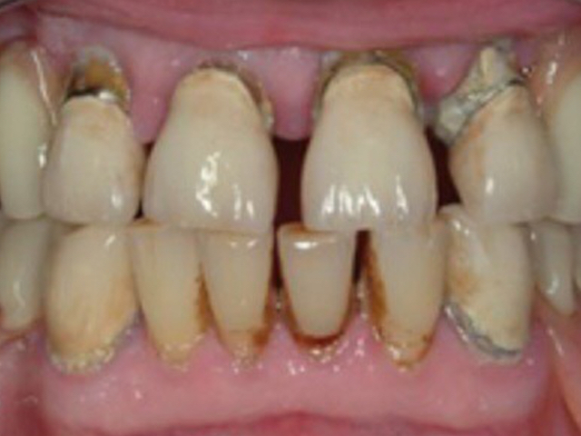Before - puredental