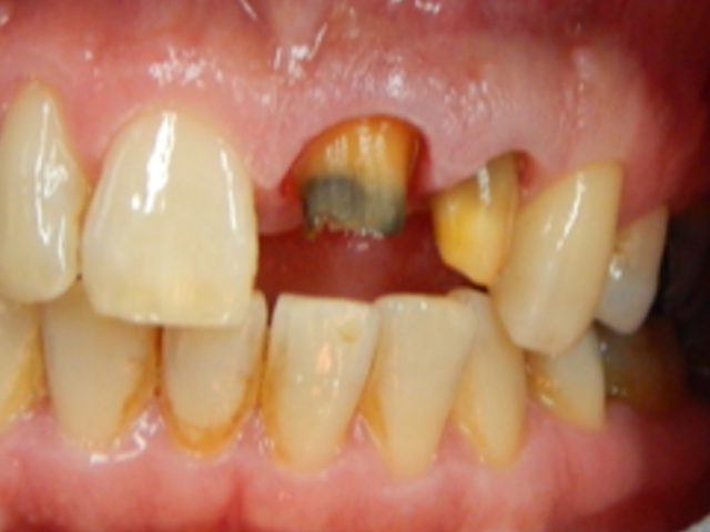 Before - puredental