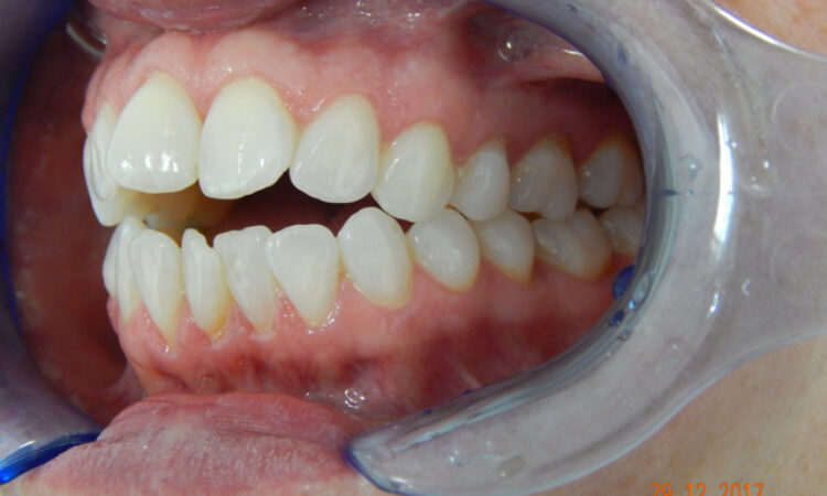 Before - puredental