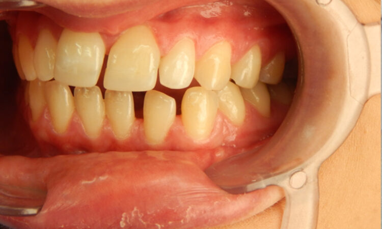 Before - puredental