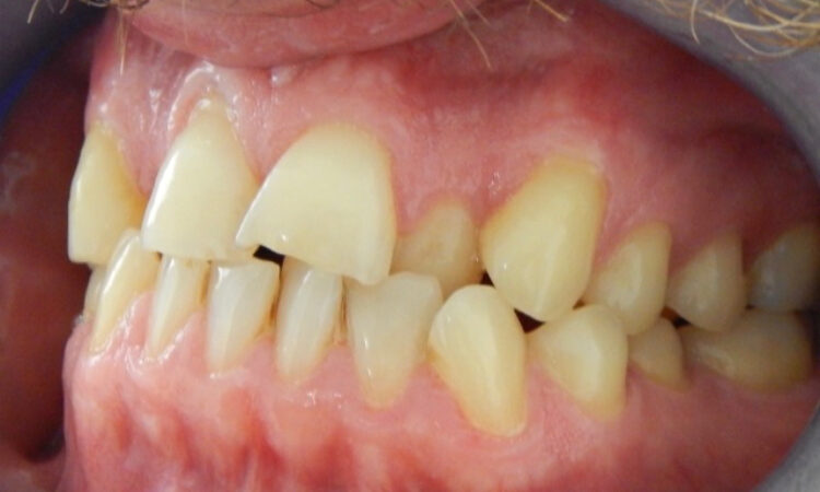 Before - puredental