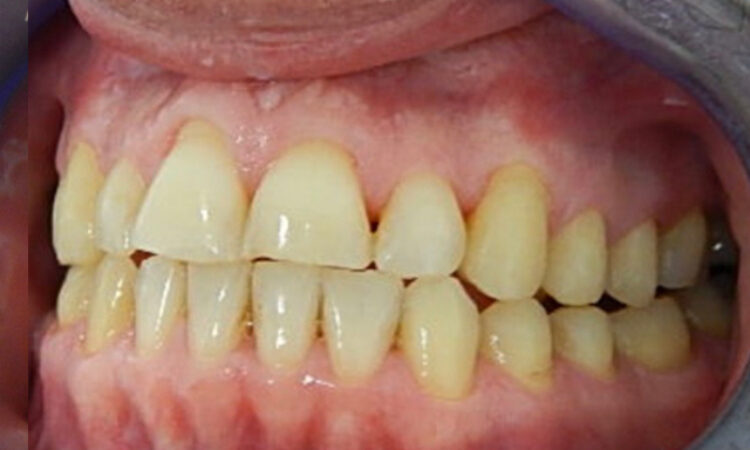After - puredental